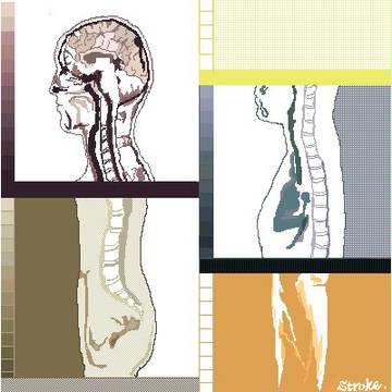 MRI