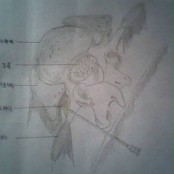椎间盘