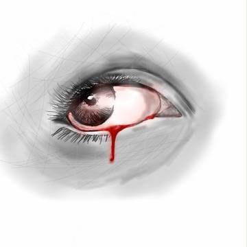 Bleeding Eye