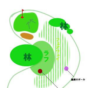 挿入