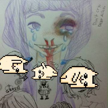 くそ