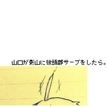山口が影山に後頭部サーブをしたら。