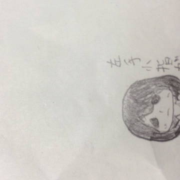 しもやけ