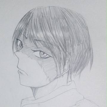 火傷Ⅰ