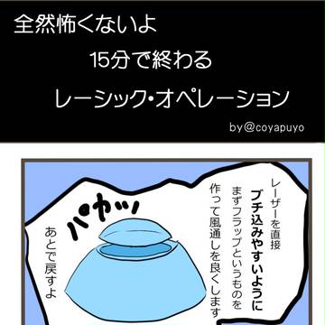 全然怖くないよ、レーシック