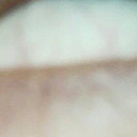 Asia Blind lady 1