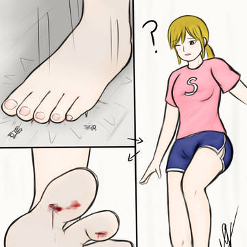 an accident