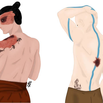 Skin