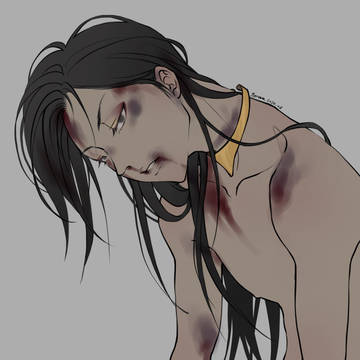 WOUND