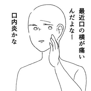口内炎(口内エピタフ)