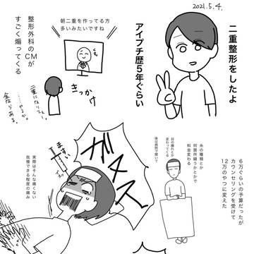 【実録】二重整形したレポ