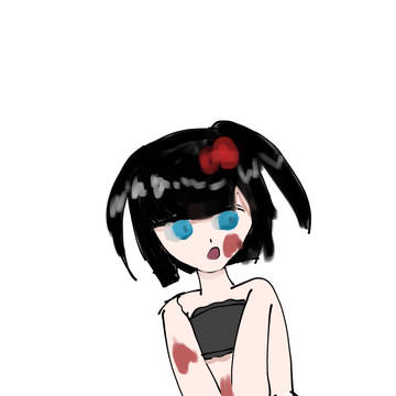 アザだらけ