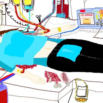 Katie's Thoracotomy