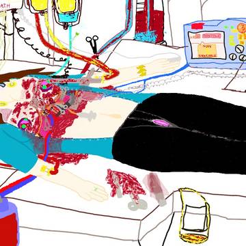 Katie's Thoracotomy