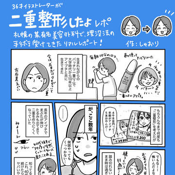 36歳イラストレーターが二重整形した話