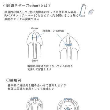 尿道テザー説明