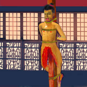 【再修正】合理的な宮刑（執行直後）