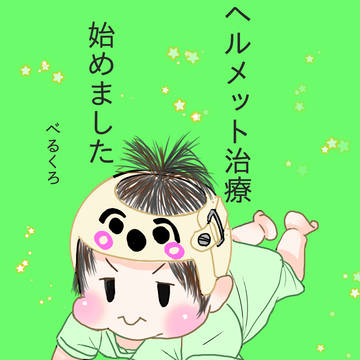 ヘルメット治療始めました1〜10