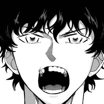 松田の差し歯の話