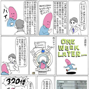 ⑥メカニックハンドと抗核抗体