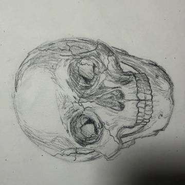 骨