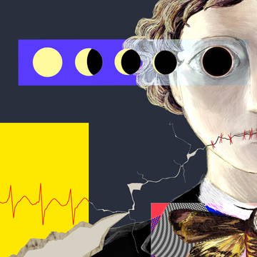 Palpitation