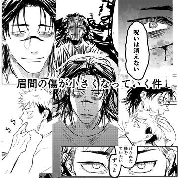 眉間の傷が小さくなっていく件