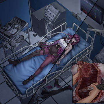 Heart removal