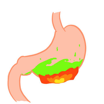 胃
