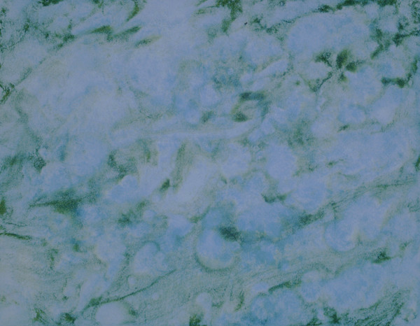 Surface