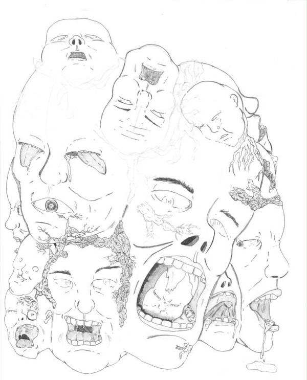 顔面増殖症