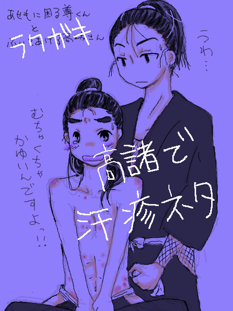 高諸で汗疹ネタ