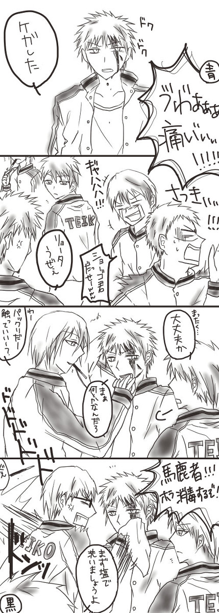 【灰崎愛され】痛みを知覚しにくい灰崎くんのお話