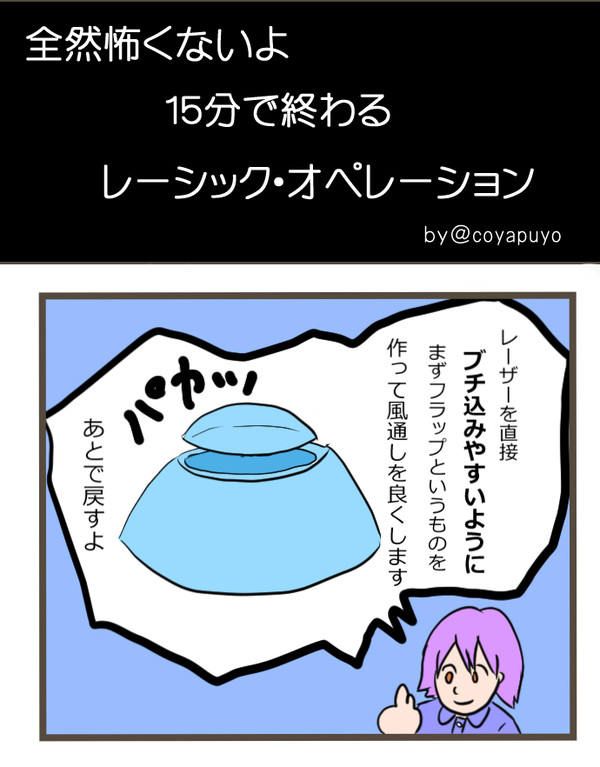 全然怖くないよ、レーシック
