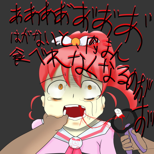 天使の抜歯