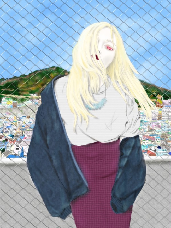 アルビノ