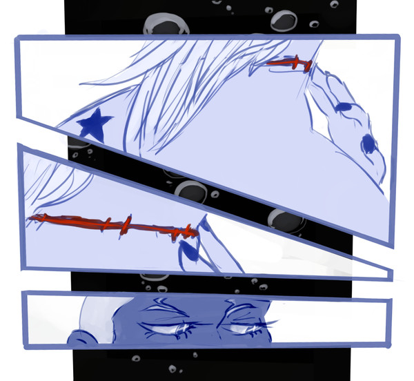Scars