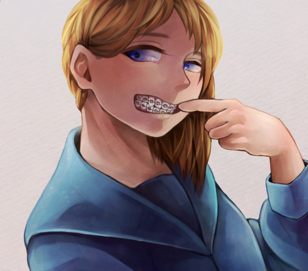 ブラケット女子