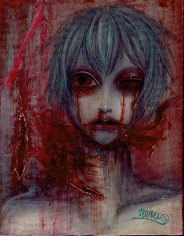 hurt