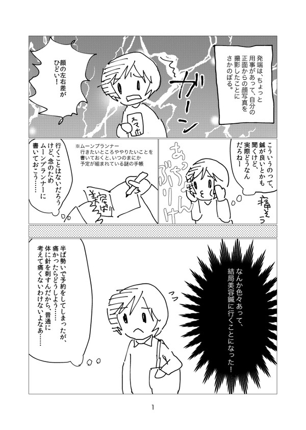 【実録漫画】美容鍼に行った話