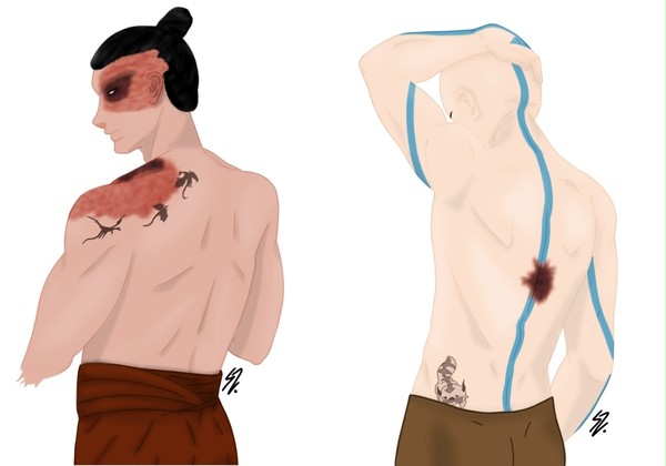 Skin