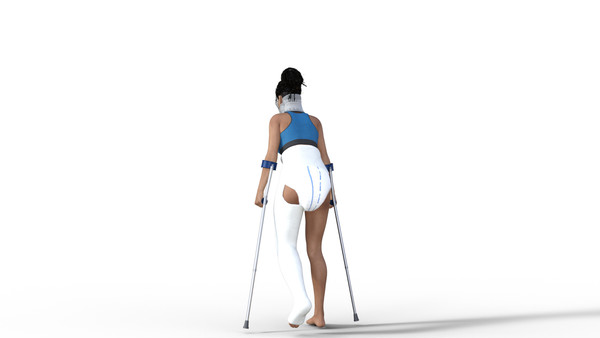 Hip Spica