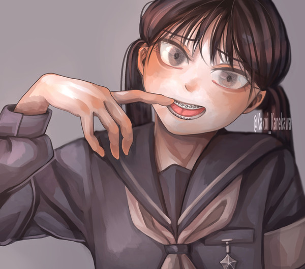 歯列矯正