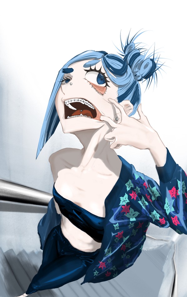 牙套妹
