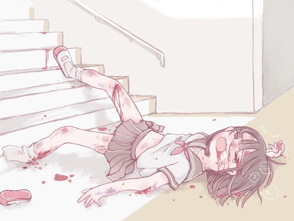 大怪我JKちゃん2