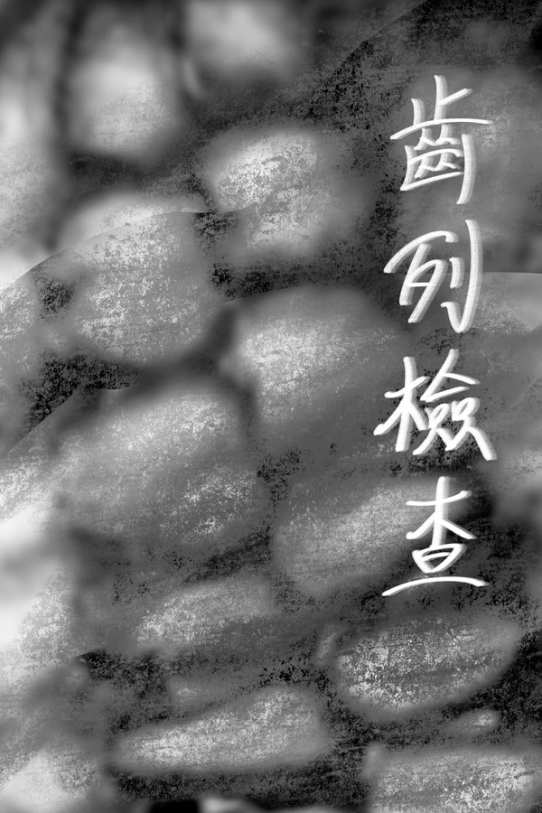 齒列檢查 上+下