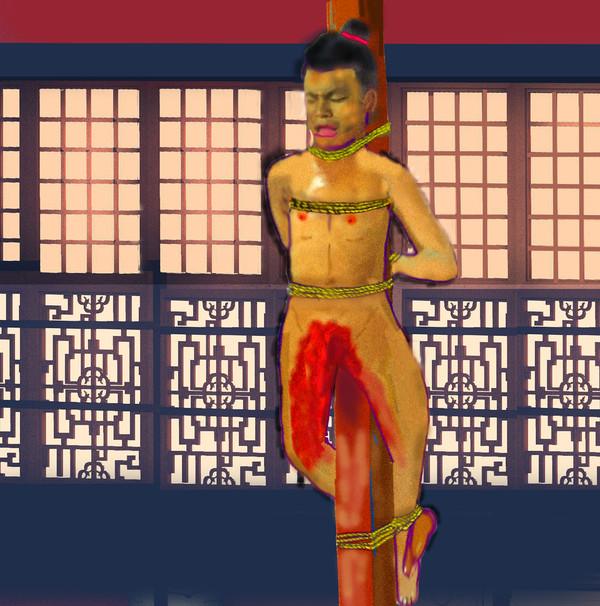 【再修正】合理的な宮刑（執行直後）