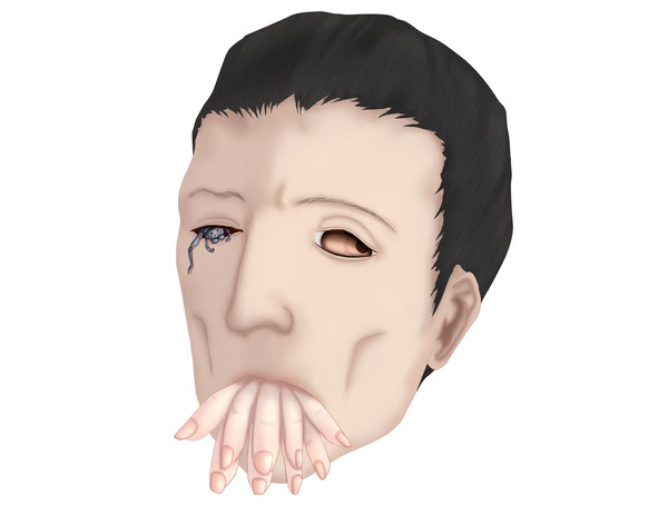 蜘蛛手