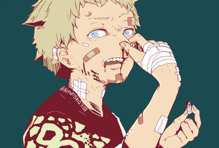EPISTAXIS BOY
