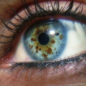 Lissecita